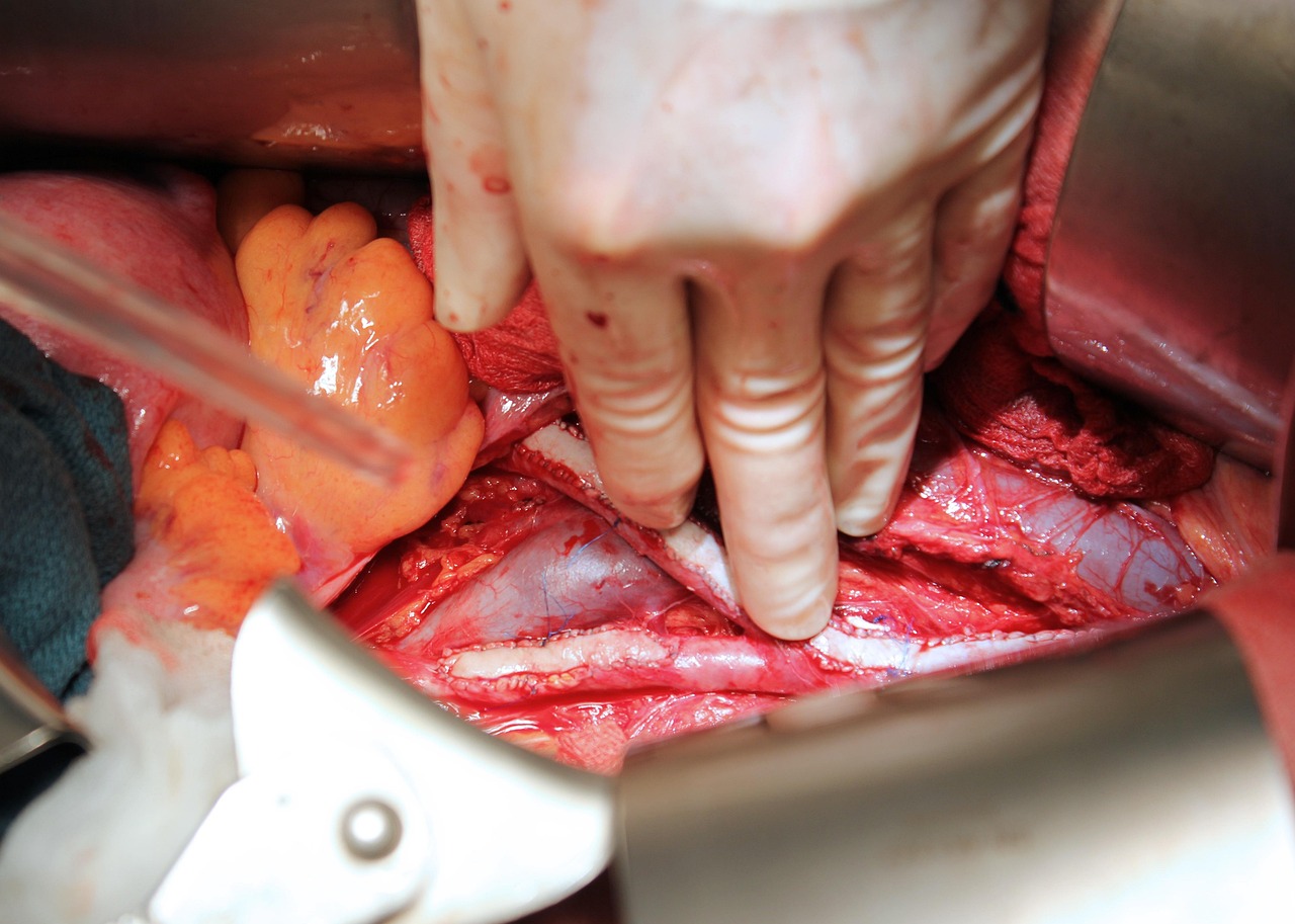 부산 인공관절 수술 잘하는 병원