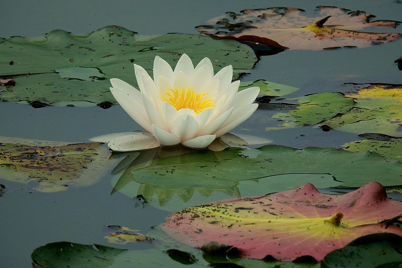 고관절 인공관절 전치환술